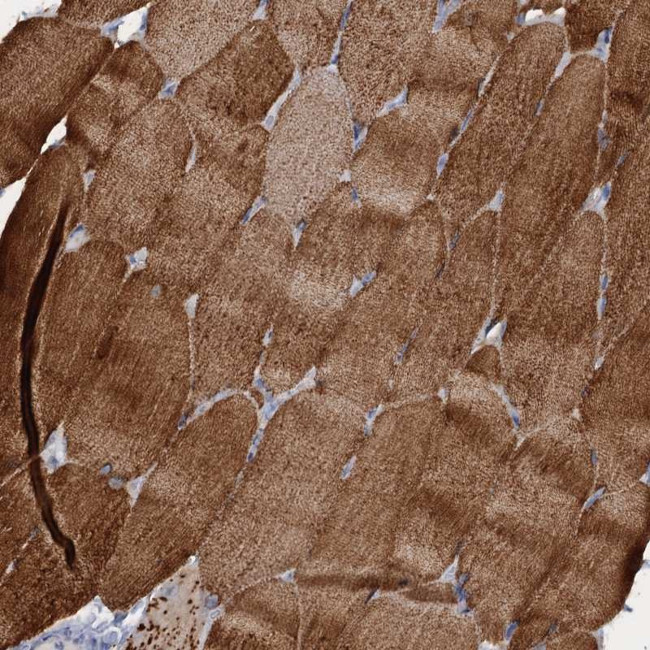 RAD9B Antibody in Immunohistochemistry (Paraffin) (IHC (P))