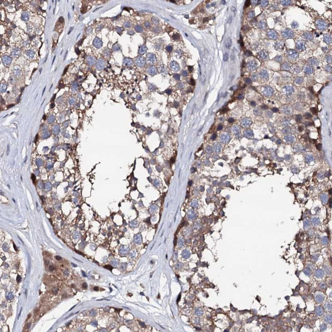 EDC3 Antibody in Immunohistochemistry (Paraffin) (IHC (P))