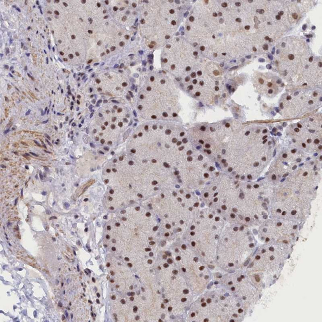 VWA9 Antibody in Immunohistochemistry (Paraffin) (IHC (P))