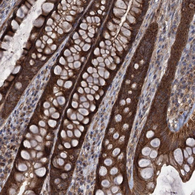 HAUS1 Antibody in Immunohistochemistry (Paraffin) (IHC (P))