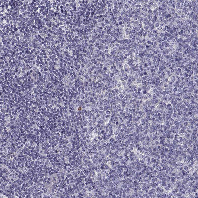CREB3L3 Antibody in Immunohistochemistry (Paraffin) (IHC (P))