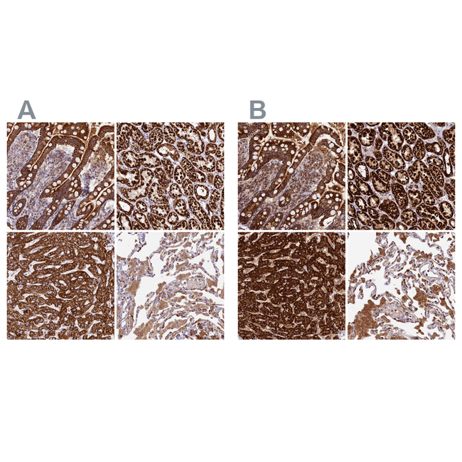 CLYBL Antibody in Immunohistochemistry (Paraffin) (IHC (P))