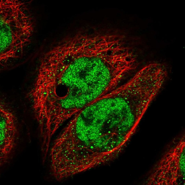 ALS Antibody in Immunocytochemistry (ICC/IF)