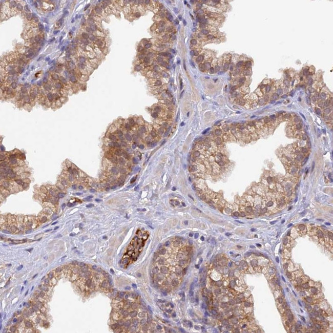 HDHD2 Antibody in Immunohistochemistry (Paraffin) (IHC (P))