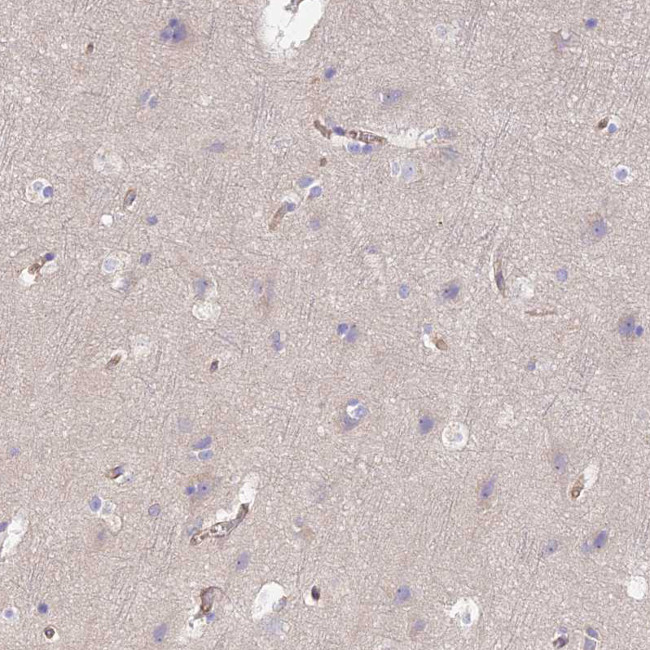 VPS18 Antibody in Immunohistochemistry (Paraffin) (IHC (P))