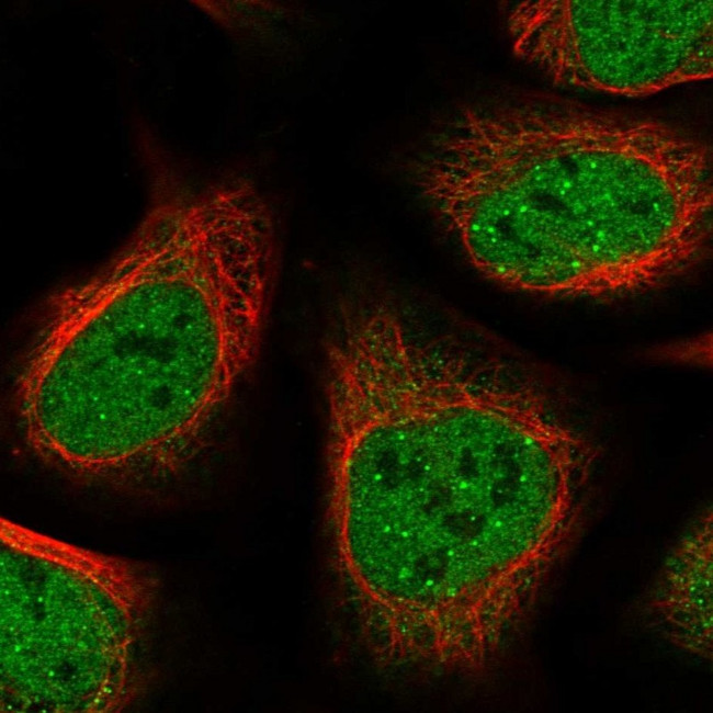 ANKRD12 Antibody in Immunocytochemistry (ICC/IF)