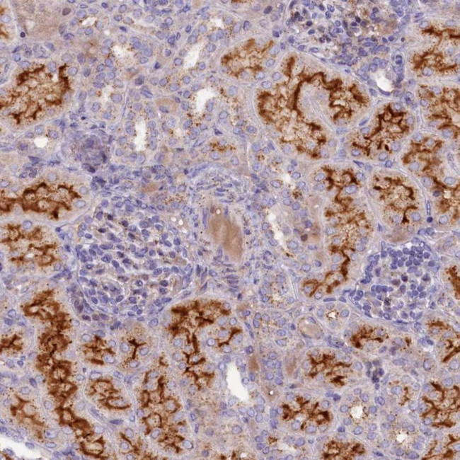 HYKK Antibody in Immunohistochemistry (Paraffin) (IHC (P))