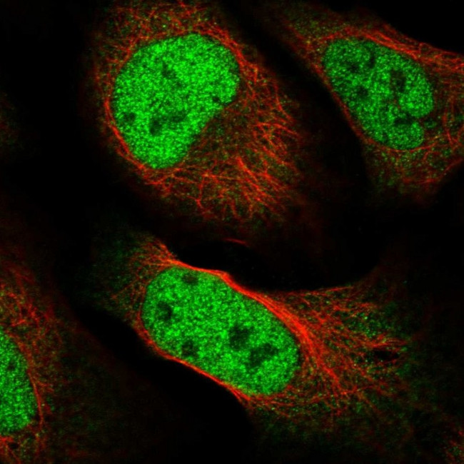 FAM59A Antibody in Immunocytochemistry (ICC/IF)