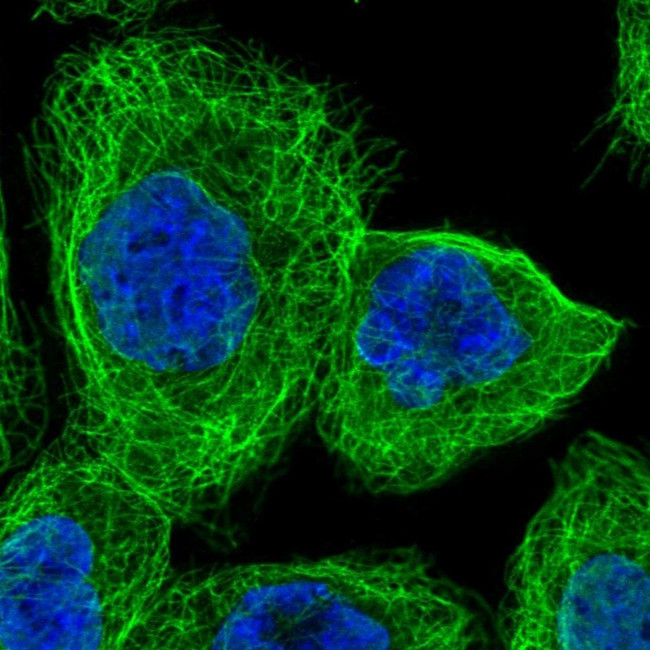 TMEM116 Antibody in Immunocytochemistry (ICC/IF)