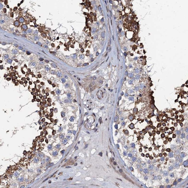KCTD4 Antibody in Immunohistochemistry (Paraffin) (IHC (P))