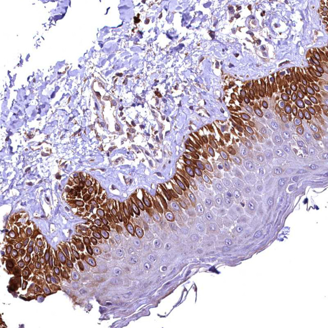 RASSF1 Antibody in Immunohistochemistry (Paraffin) (IHC (P))