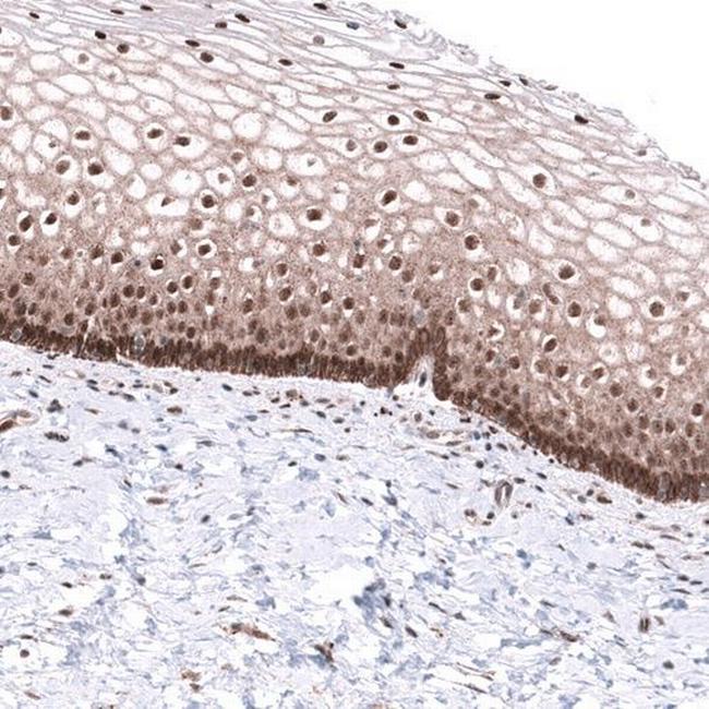 C20orf196 Antibody in Immunohistochemistry (Paraffin) (IHC (P))