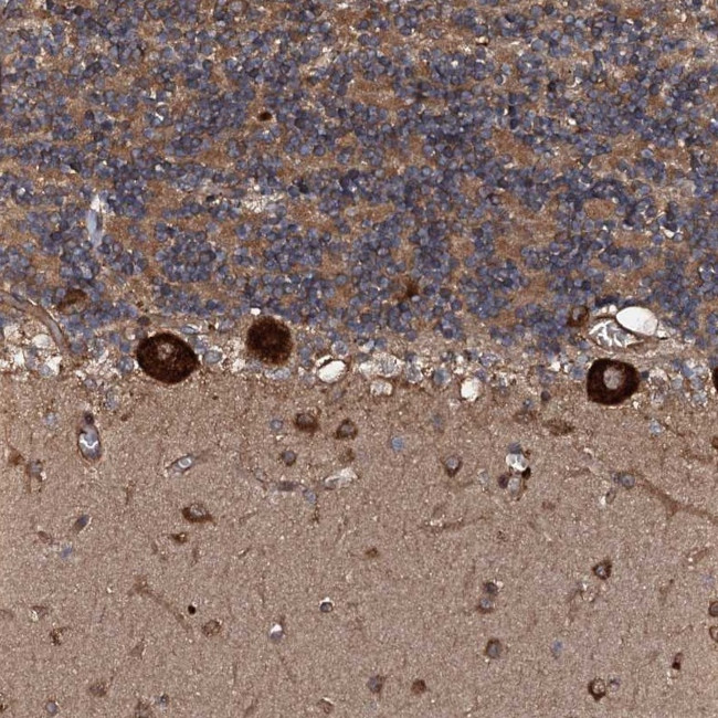 FLYWCH1 Antibody in Immunohistochemistry (Paraffin) (IHC (P))