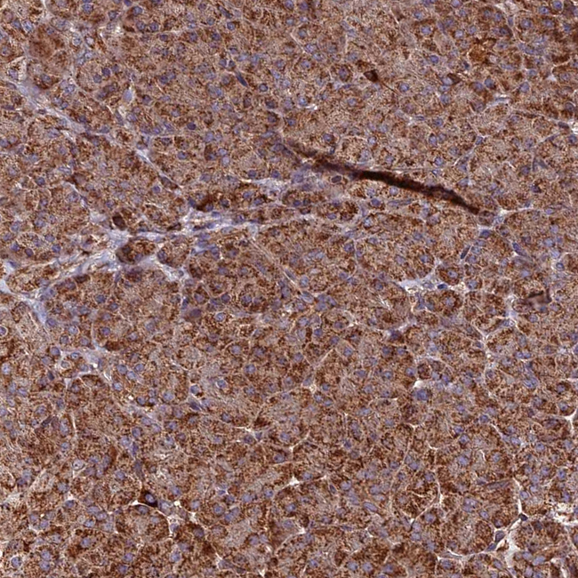 HERPUD1 Antibody in Immunohistochemistry (Paraffin) (IHC (P))