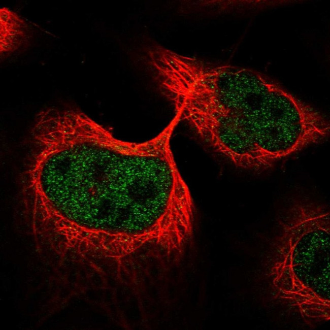 ANKDD1A Antibody in Immunocytochemistry (ICC/IF)