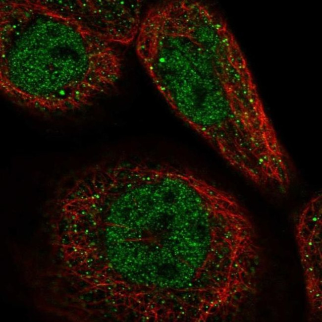 CCDC113 Antibody in Immunocytochemistry (ICC/IF)