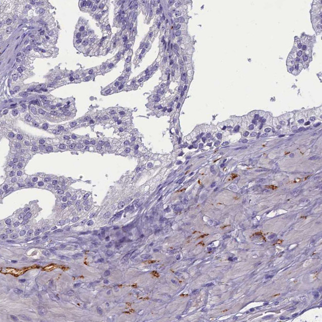 SV2C Antibody in Immunohistochemistry (Paraffin) (IHC (P))