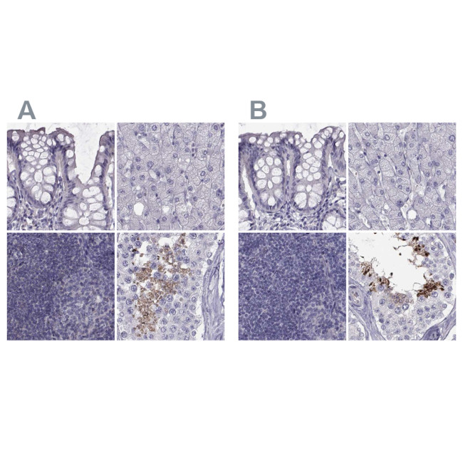 FAM71B Antibody in Immunohistochemistry (IHC)
