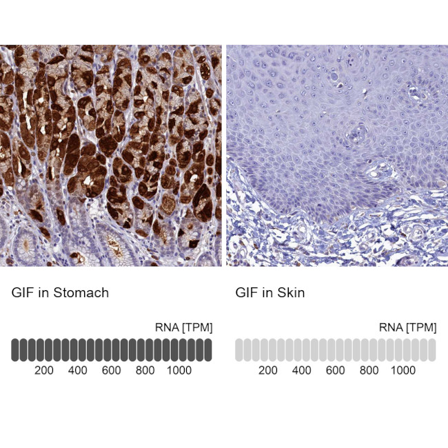 GIF Antibody in Immunohistochemistry (IHC)