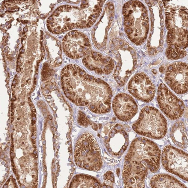 LRRC28 Antibody in Immunohistochemistry (Paraffin) (IHC (P))