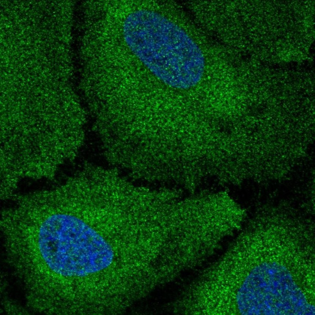 CDAN1 Antibody in Immunocytochemistry (ICC/IF)