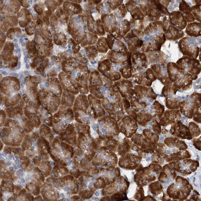 DNAJC21 Antibody in Immunohistochemistry (Paraffin) (IHC (P))
