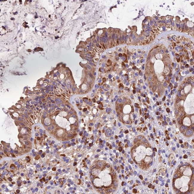 METTL22 Antibody in Immunohistochemistry (Paraffin) (IHC (P))