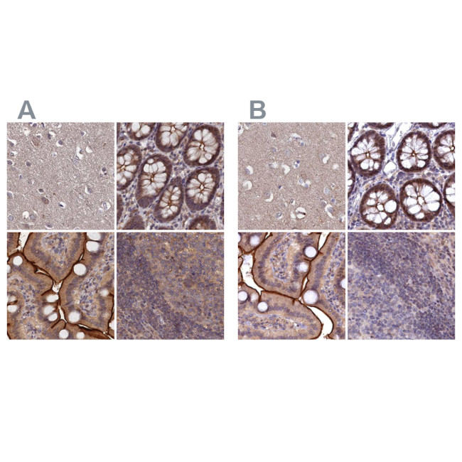 TMC5 Antibody in Immunohistochemistry (IHC)
