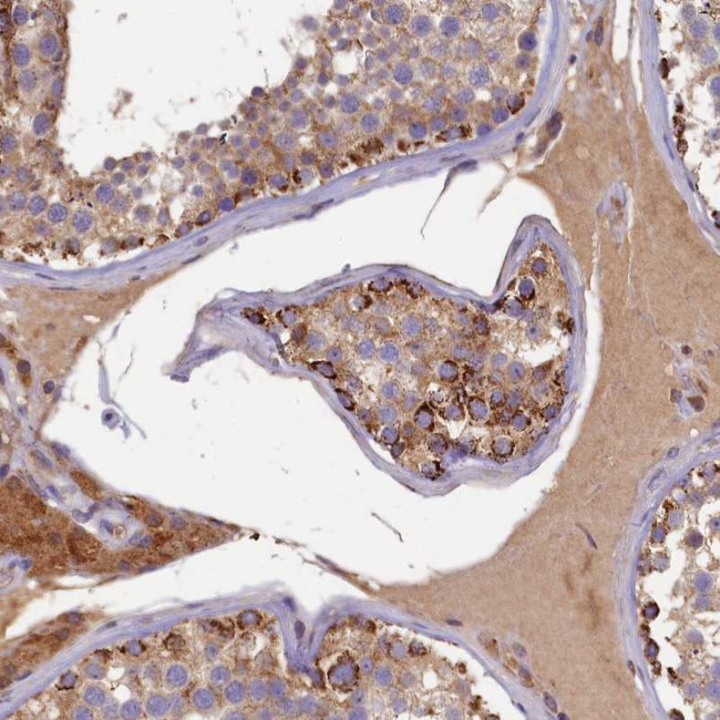 SEC31B Antibody in Immunohistochemistry (Paraffin) (IHC (P))