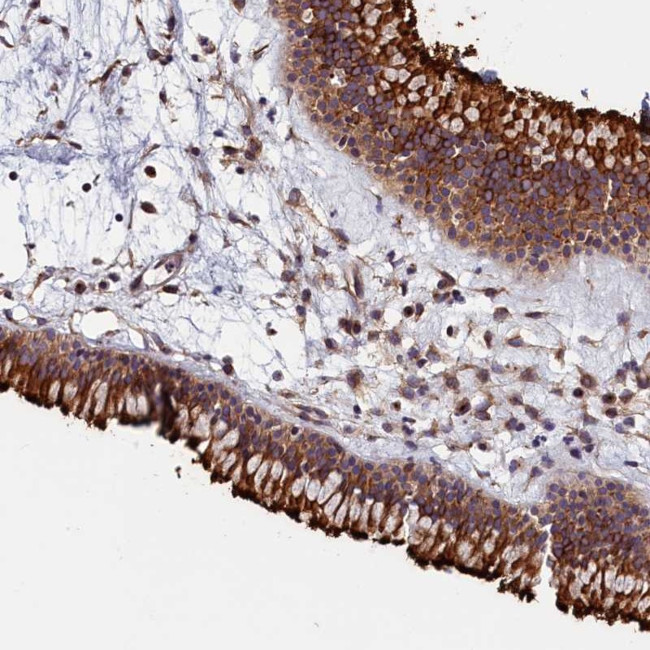 GRXCR1 Antibody in Immunohistochemistry (Paraffin) (IHC (P))