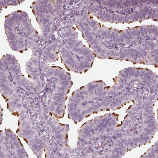 FAM154B Antibody in Immunohistochemistry (IHC)