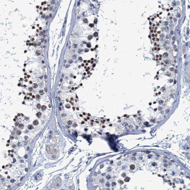 C16orf95 Antibody in Immunohistochemistry (Paraffin) (IHC (P))