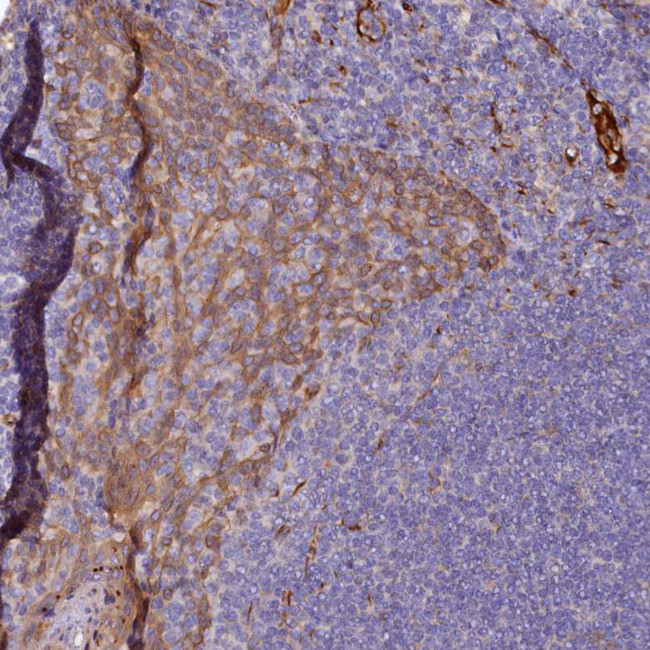 ARL11 Antibody in Immunohistochemistry (Paraffin) (IHC (P))