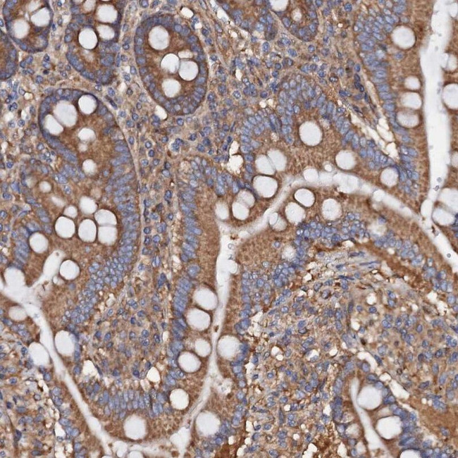 MRPL48 Antibody in Immunohistochemistry (IHC)