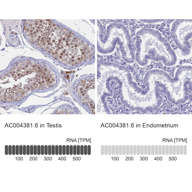 LOC81691 Antibody in Immunohistochemistry (IHC)
