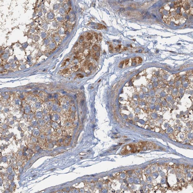 ARL11 Antibody in Immunohistochemistry (Paraffin) (IHC (P))