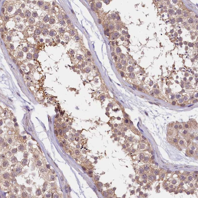 UBXN6 Antibody in Immunohistochemistry (Paraffin) (IHC (P))