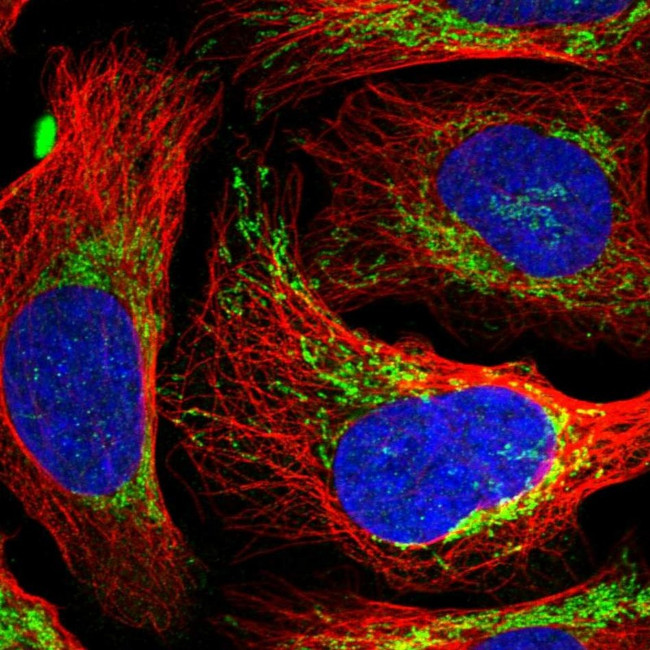 EVC2 Antibody in Immunocytochemistry (ICC/IF)