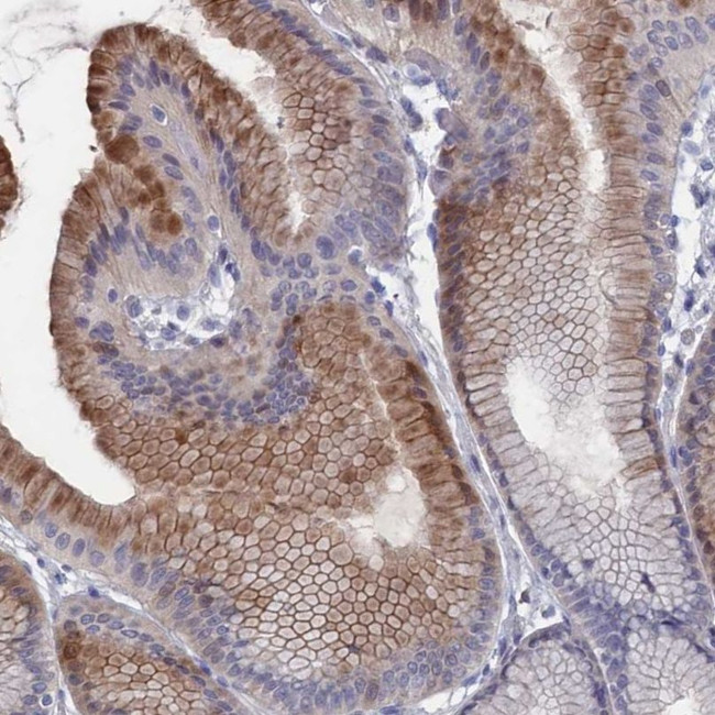 NUTF2 Antibody in Immunohistochemistry (IHC)