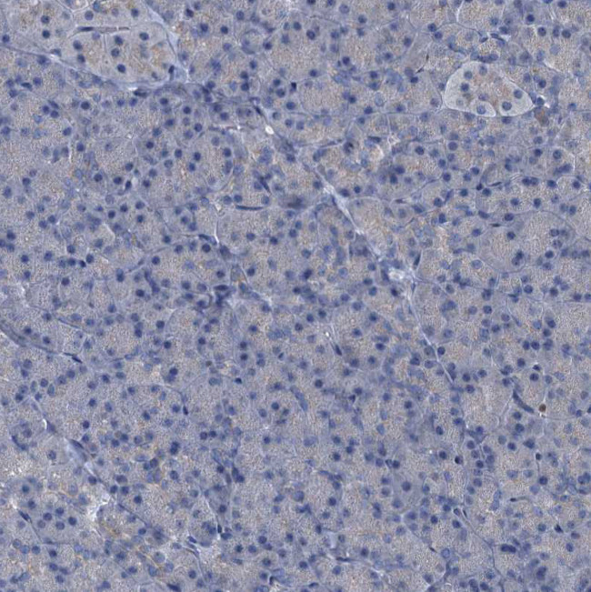 NAT15 Antibody in Immunohistochemistry (Paraffin) (IHC (P))