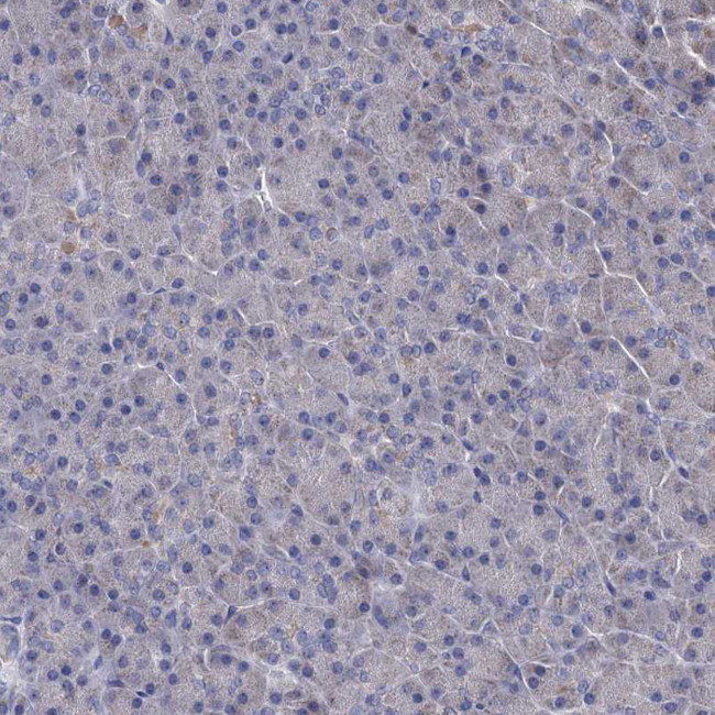 CPPED1 Antibody in Immunohistochemistry (Paraffin) (IHC (P))