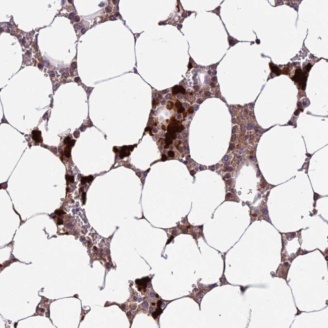 AHSP Antibody in Immunohistochemistry (Paraffin) (IHC (P))