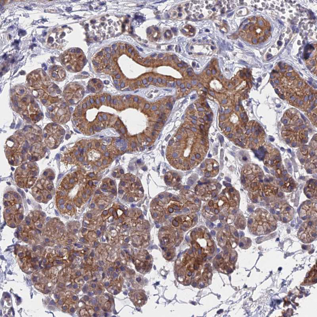 ZCCHC2 Antibody in Immunohistochemistry (Paraffin) (IHC (P))
