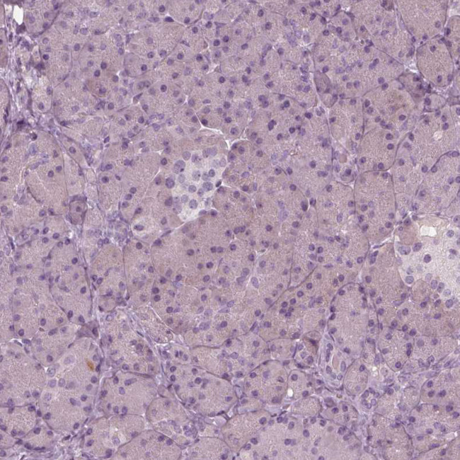 PSTPIP2 Antibody in Immunohistochemistry (Paraffin) (IHC (P))