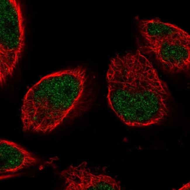 ALS Antibody in Immunocytochemistry (ICC/IF)