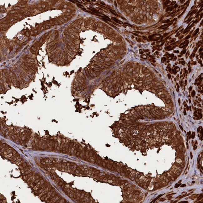 CCDC102A Antibody in Immunohistochemistry (Paraffin) (IHC (P))