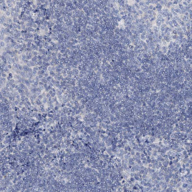 DTD1 Antibody in Immunohistochemistry (Paraffin) (IHC (P))