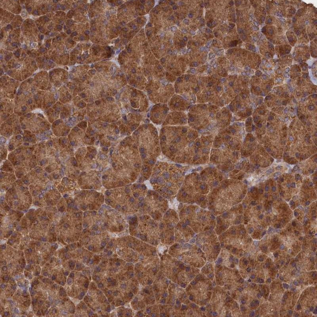 SNX33 Antibody in Immunohistochemistry (Paraffin) (IHC (P))