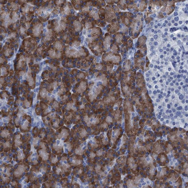 C10orf88 Antibody in Immunohistochemistry (Paraffin) (IHC (P))