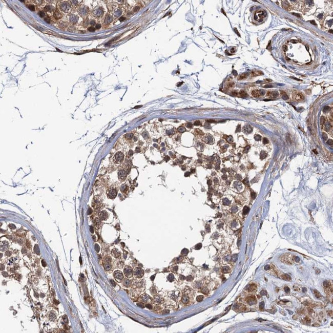 FSIP1 Antibody in Immunohistochemistry (Paraffin) (IHC (P))